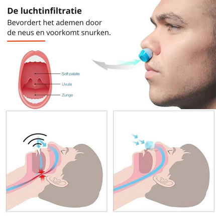SleepPure – Innovatief Anti-Snurk & Luchtzuiveraar